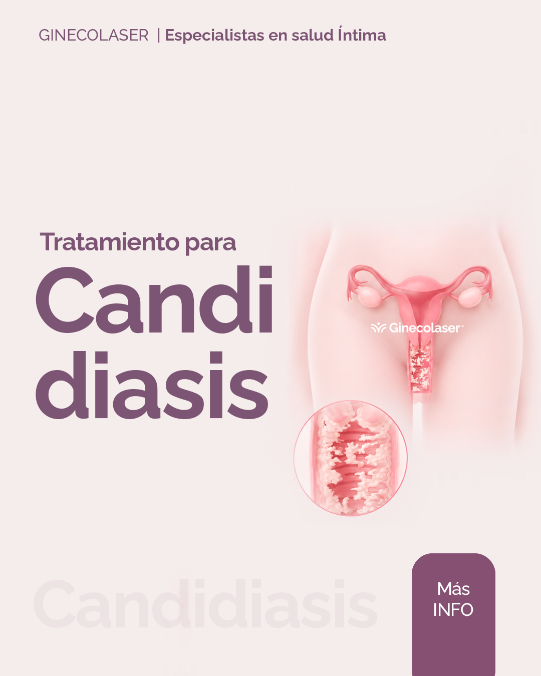 Candidiasis Recidivante